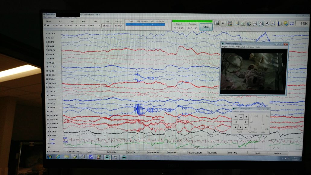 Deni De Grossesse Se Voit Sur Un Test Les ondes du bonheur - Olive et Érable